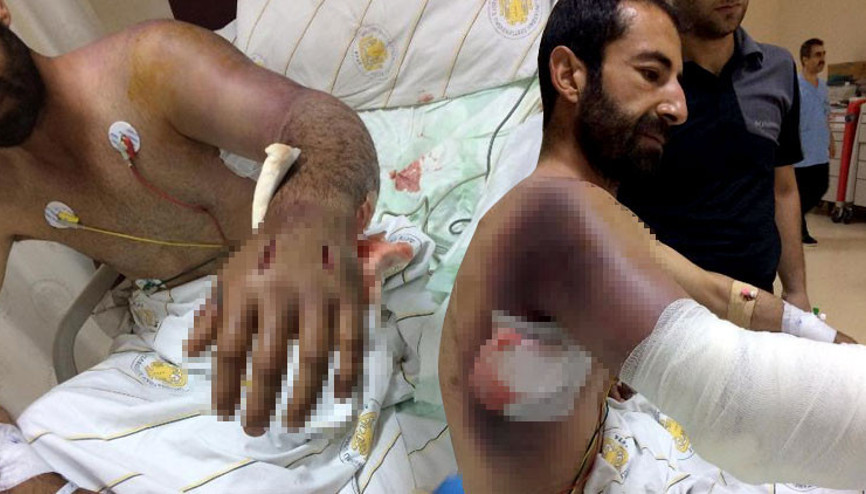 Diyarbakırda korkunç olay Yılan bu hale getirdi...