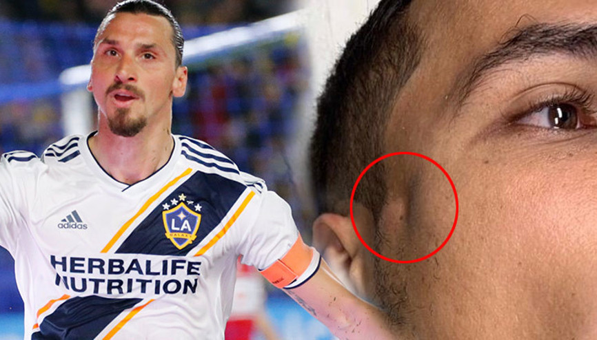 Ibrahimovic rakibini hastanelik etti