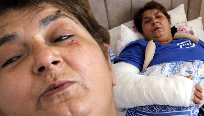 Baltalı saldırıda bu hale geldi Sonum Emine Bulut gibi olacak