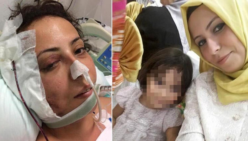 Küçük kızının gözü önünde vurulan Tuğba Anlak hayatını kaybetti