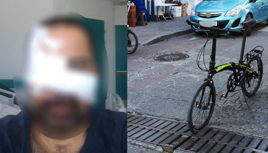 Bisiklet yolunda akıl almaz kaza Yüzüne 25 vida 8 plak takıldı