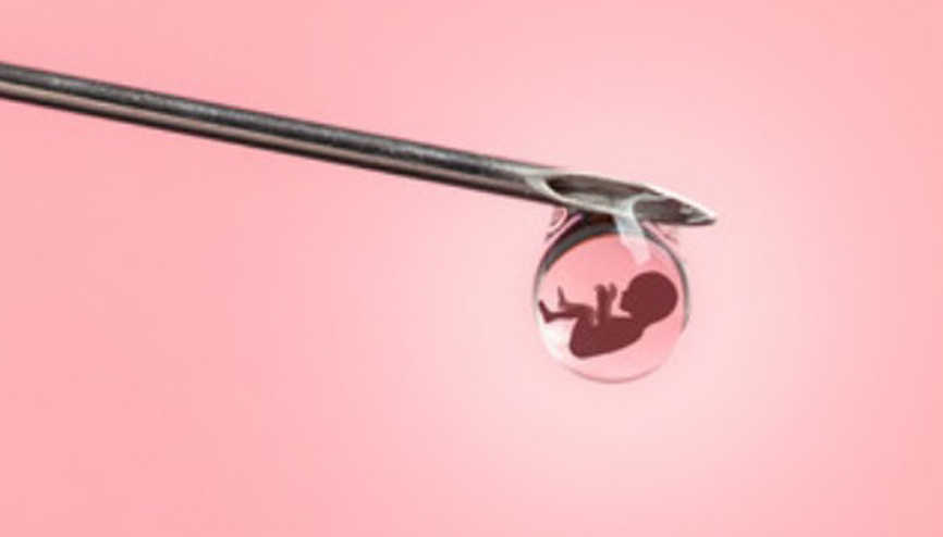 Mitokondri ne demek Mitokondri nakli nedir Mitokondri ne demek Mitokondri nakli nedir