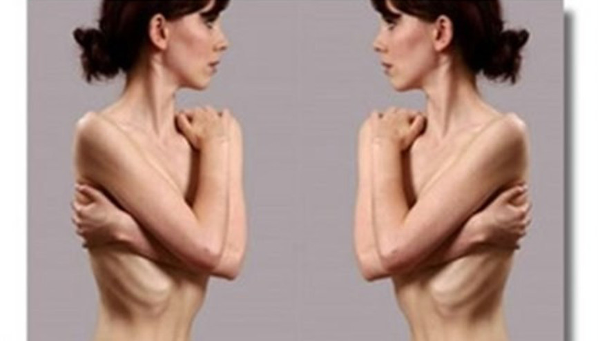 Sağlıklı şekilde kilo alma