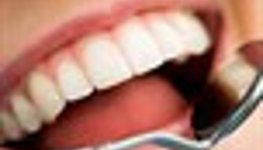 Dişeti çekilmesinin tedavisi yok