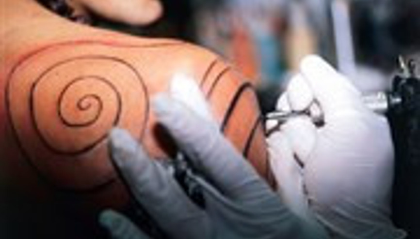 Dövmelerinizden Tamamen Kurtulmak Mümkün