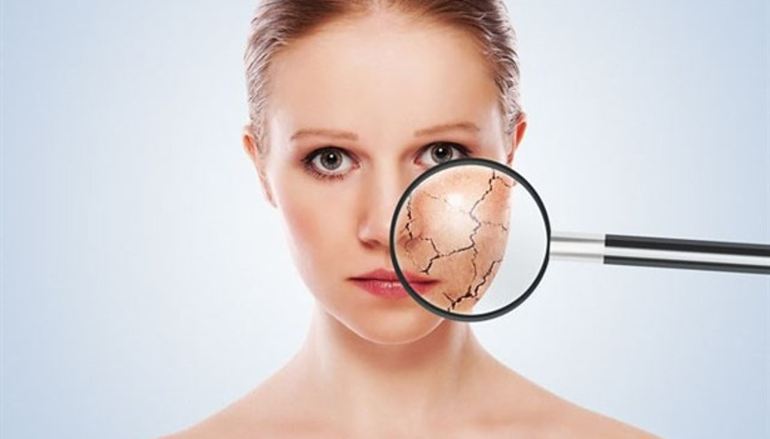 Sıcaklıklar Cildi Yakmasın