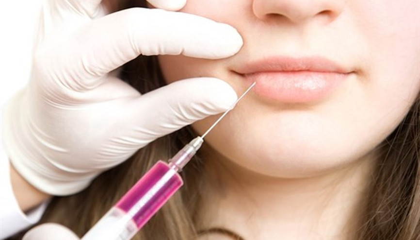 Sizce Dolgu Estetiği ile Güzelleşmek Mümkün Mü