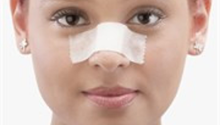 Burun Estetiği Sonrası İyileşme Süreci Zor Mu