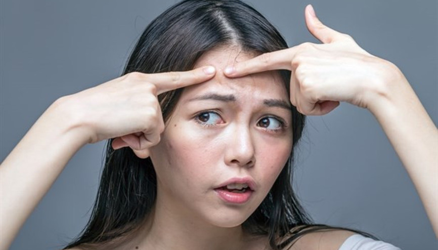 En Etkili Akne Tedavisi Nedir