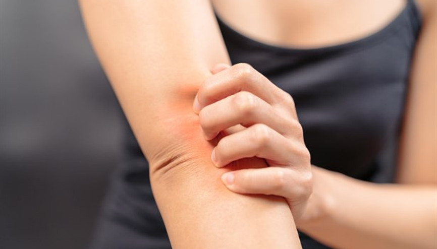 Kaşıntınız Varsa Böbrekleriniz Sinyal Veriyor Olabilir