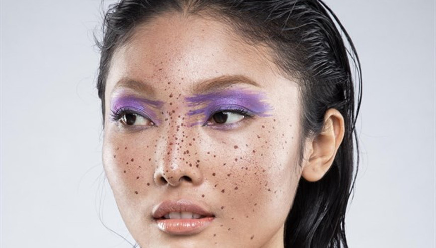 Ciltteki Ben Sayısı 50’yi Geçiyorsa Dikkat Ciltteki Ben Sayısı 50’yi Geçiyorsa Dikkat