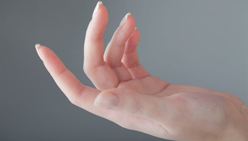 Her El Titremesi Parkinson Değildir