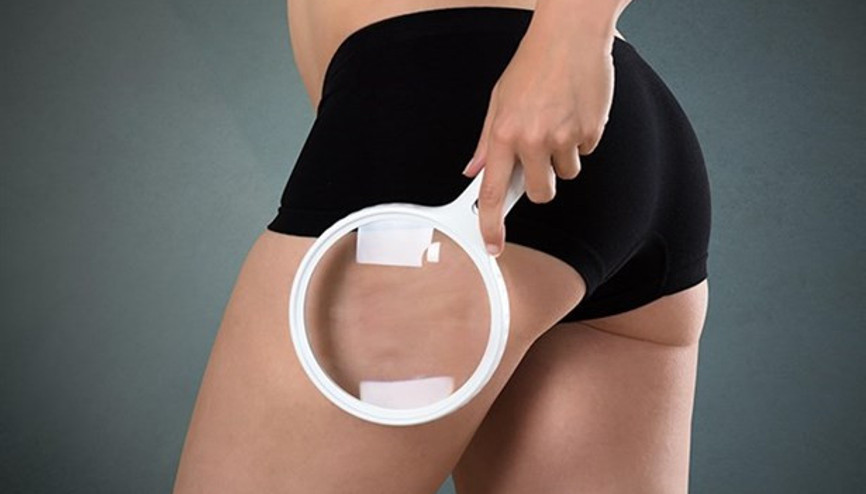 Selülit Nasıl Geçer ve Ne İyi Gelir Selülit Neden Olur Evde Selüliti Geçirecek Bitkisel Çözümler ve Doğal Yollar Selülit Nasıl Geçer ve Ne İyi Gelir Selülit Neden Olur Evde Selüliti Geçirecek Bitkisel Çözümler ve Doğal Yollar