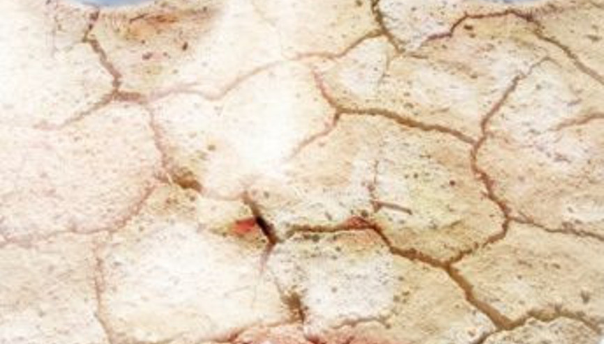 Cilt Kuruluğuyla İlgili 5 Soru 5 Cevap