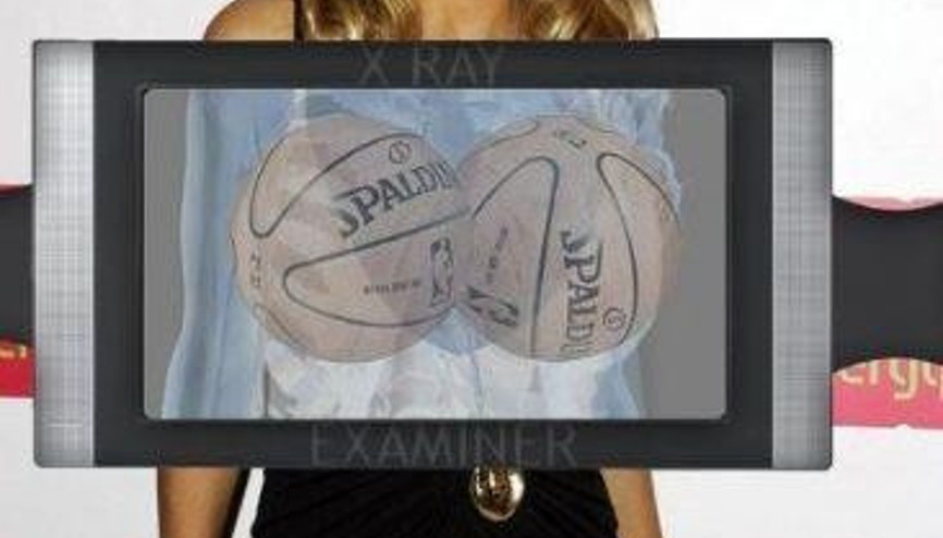 Xray altında komik anlar