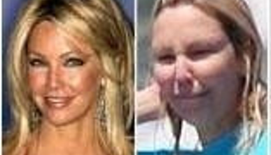 Sandığınız kadar güzel değiller