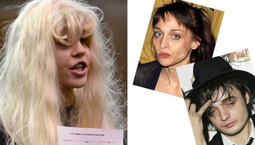 Kötü Alışkanlıkları Yüzünden Bu Hale Geldiler