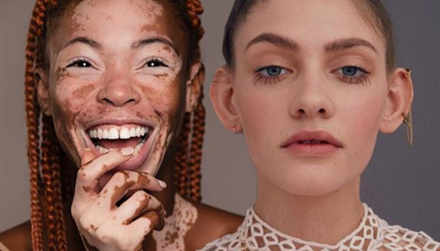 Güzellik Standartlarını Yenileyen Kadınlar