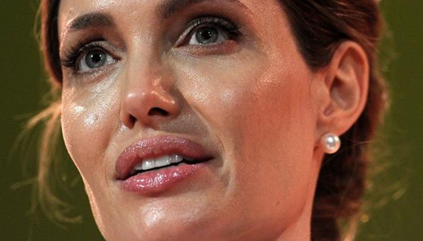 Yağlı Ciltlerin Yapıp-Yapmaması Gerekenler