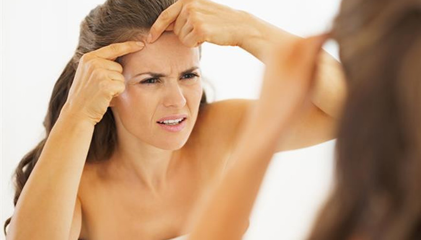 Sivilceyi ne kurutur Sivilceleri Kurutmak İçin Hızlı Etkili Sivilce Kurutucu 12 Yöntem