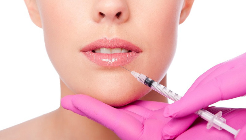 Liplift (Dudak Kaldırma) Nedir Kimlere Uygulanır