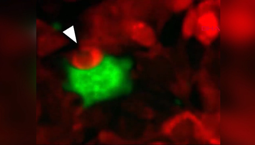 Kanser hücrelerinin nasıl hayatta kaldıkları keşfedildi