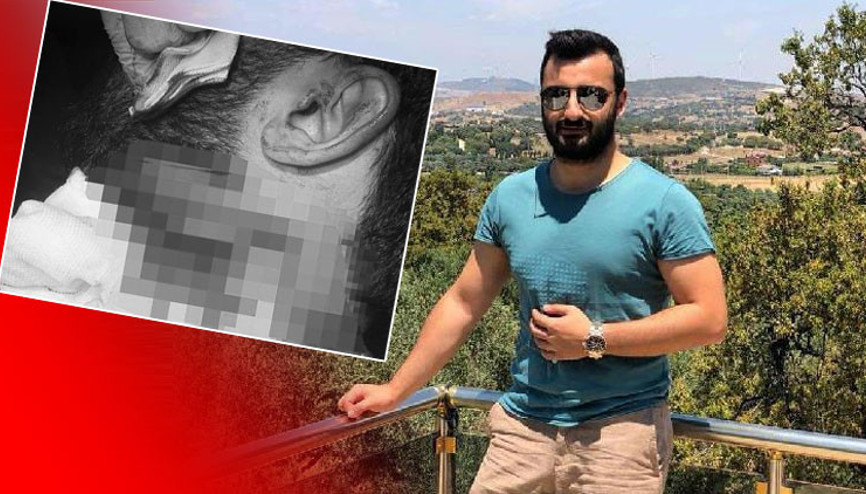 Doktora jiletli saldırıda flaş gelişme