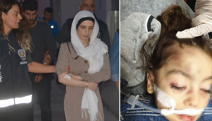 Üvey anne şiddeti komaya soktu