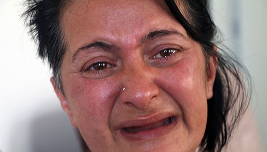 Beyaz diş hayaliyle 32 dişinden olmuştu Bu kez de unutkanlıktan şikâyetçi