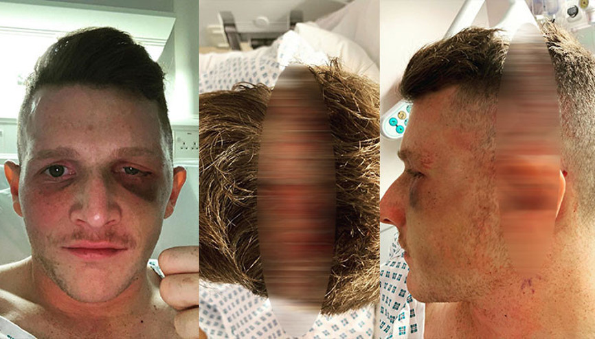 Korkunç sakatlık Yıldız hokeyci Sam Ward sol gözünü kaybetti...