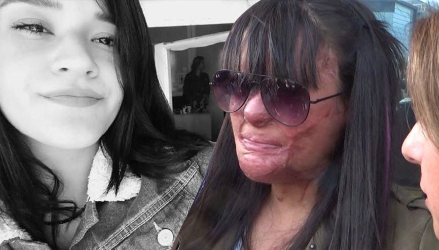 Yüzüne asit atılan Berfin duruşmaya ilk kez katıldı Yüzüne asit atılan Berfin duruşmaya ilk kez katıldı