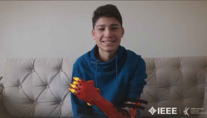 Üniversite öğrencilerinden 14 yaşındaki Mehmete robot el