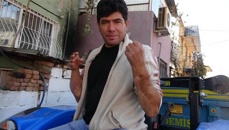 Tıp tarihine geçen çiftçi, nakil kollarıyla yaşama tutunuyor