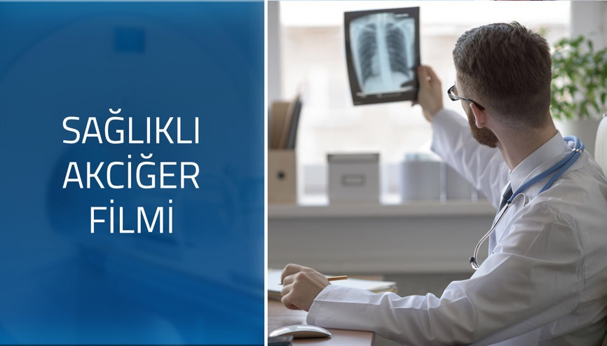 Sağlıklı akciğer filmi nasıl olmalı Sağlıklı akciğer filmi nasıl olmalı