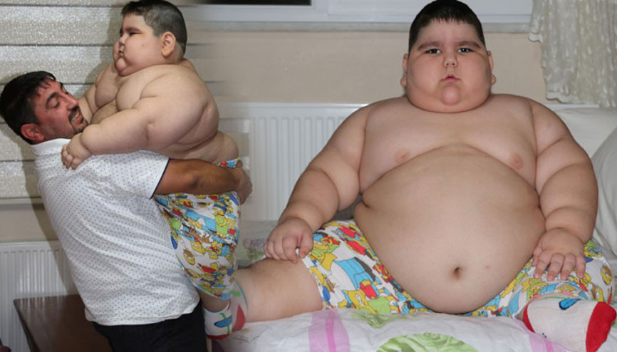 4 yaşında 70 kiloya ulaşan Yağız, yardım bekliyor