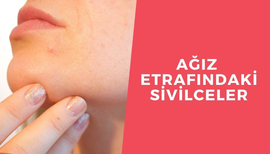 Ağız etrafı sivilceleri nasıl yok edilir