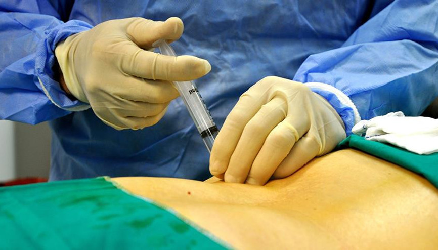 Kasık fıtığı belirtileri neler Kasık fıtığı neden olur ve tedavisi nasıl yapılır Kasık fıtığı belirtileri neler Kasık fıtığı neden olur ve tedavisi nasıl yapılır