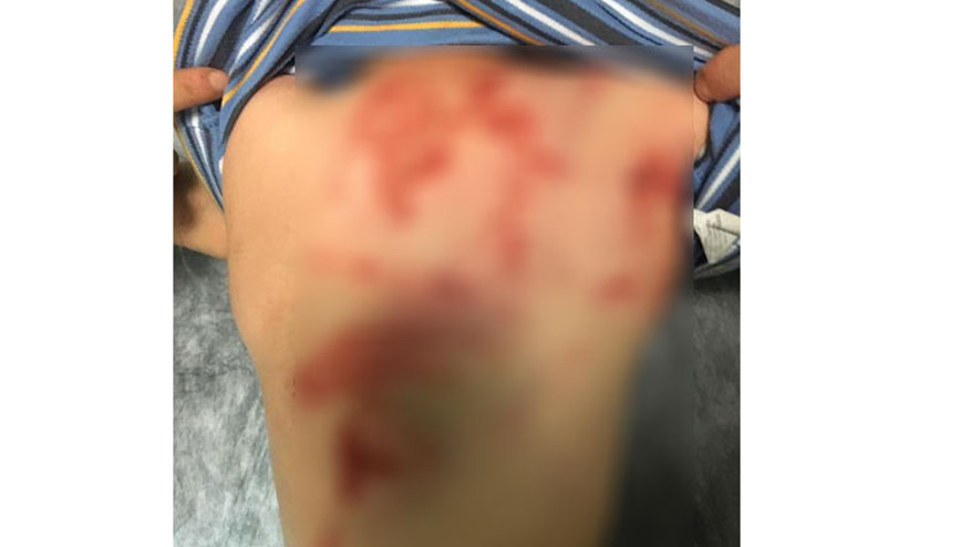 Her satırı iğrenç Küçük çocuk eve gelince ailesi fark etti