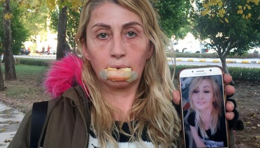 Güzellik uğruna hayatı karardı