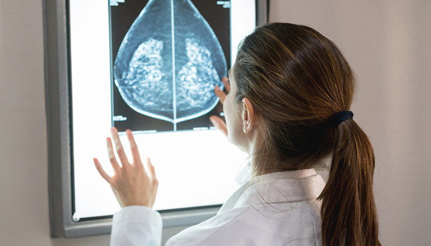 Kandan Yapılan Kanser Belirteçleri Her Zaman Kanser Belirtir mi