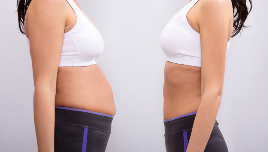 Vücut şekillendirmede yeni yöntem: J-Plasma Vücut şekillendirmede yeni yöntem: J-Plasma