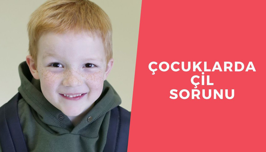 Yüzdeki çiller neden olur Çillenmenin nedeni ve tedavisi
