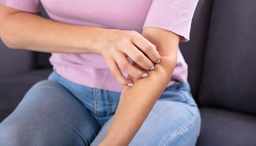 Uyuz hastalığı belirtileri nelerdir Kış aylarında uyuza dikkat