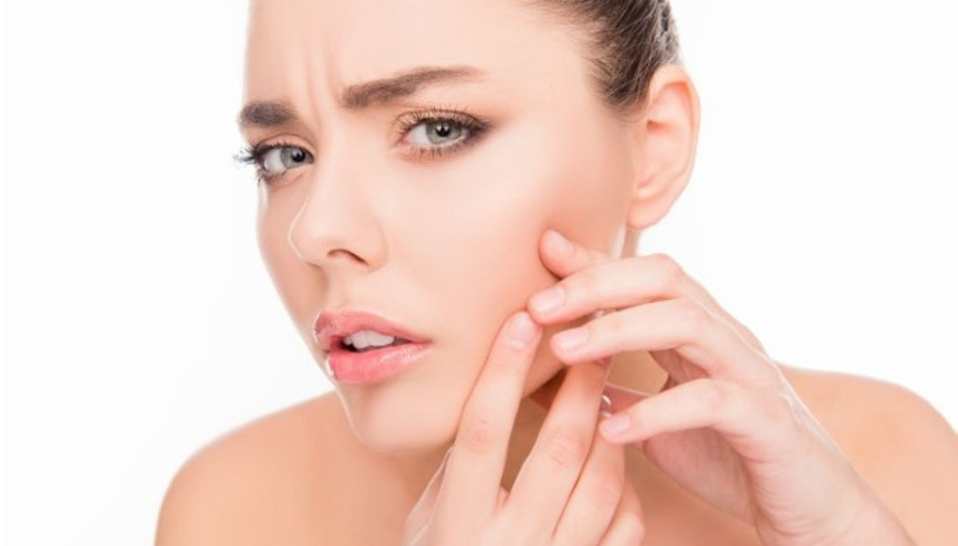 Sivilce İzleri Nasıl Geçer