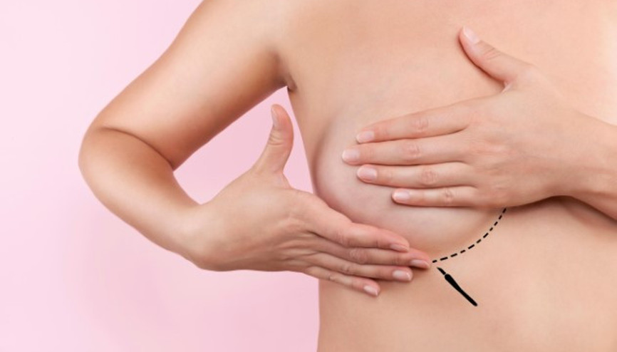 Meme Estetiğinde Göğüslerde Hissizlik Oluşur mu Meme Estetiğinde Göğüslerde Hissizlik Oluşur mu