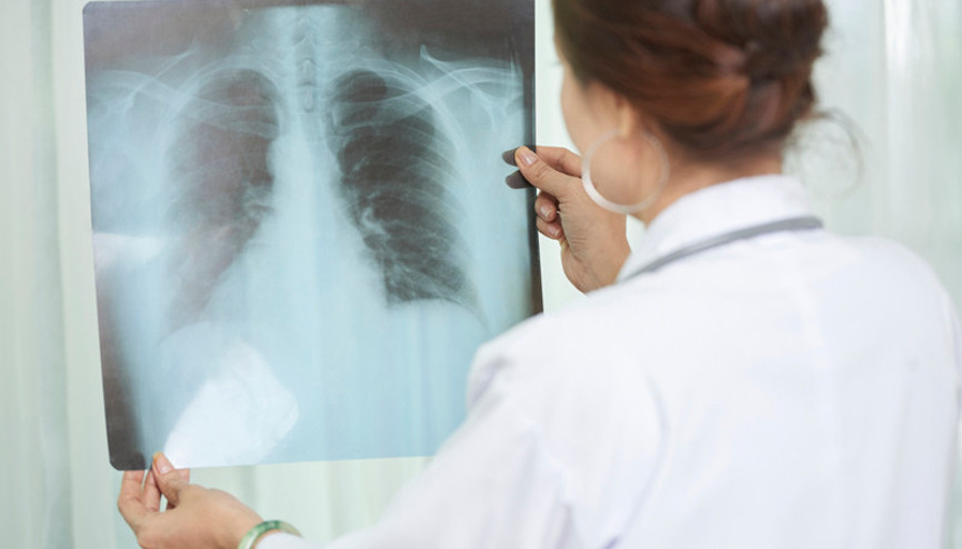 Uzun süreli öksürük ve yorgunluk verem işareti olabilir