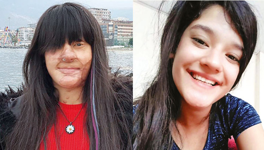 Erdoğan’dan ‘Berfin’ çıkışı: Yüzüne kezzap atana ‘alçak’ dedi