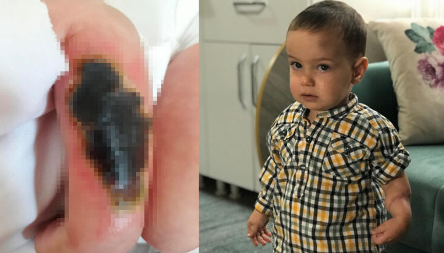 İsa bebeğin kolundaki yaranın sebebi bulunamıyor