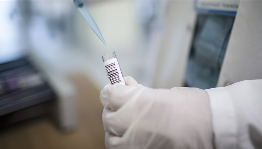 Uyuz salgını yeniden gündemde – Uyuz nedir, nasıl anlaşılır