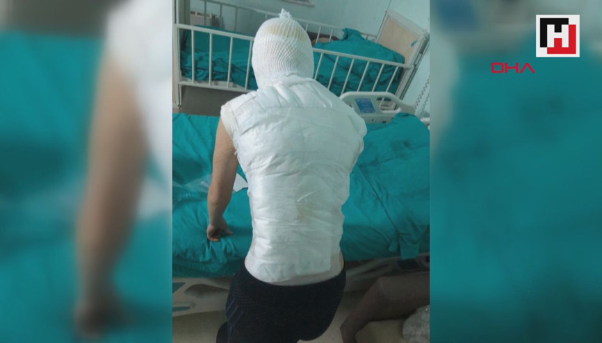 Ümraniyede üvey anne dehşeti iddiası